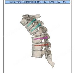 Neurochirurgia vertebrale Di Venere 1